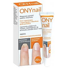 ONYnail 1/1